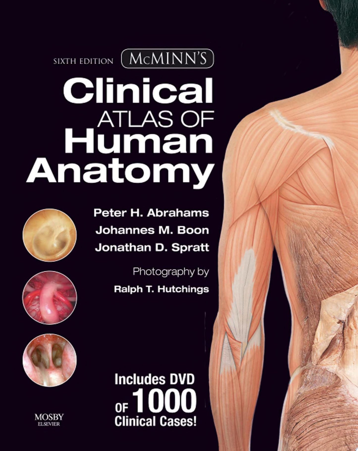 McMinn's Clinical Atlas of Human Anatomy by Peter Abrahams, Jonathan Spratt, Johannes Boon - USED